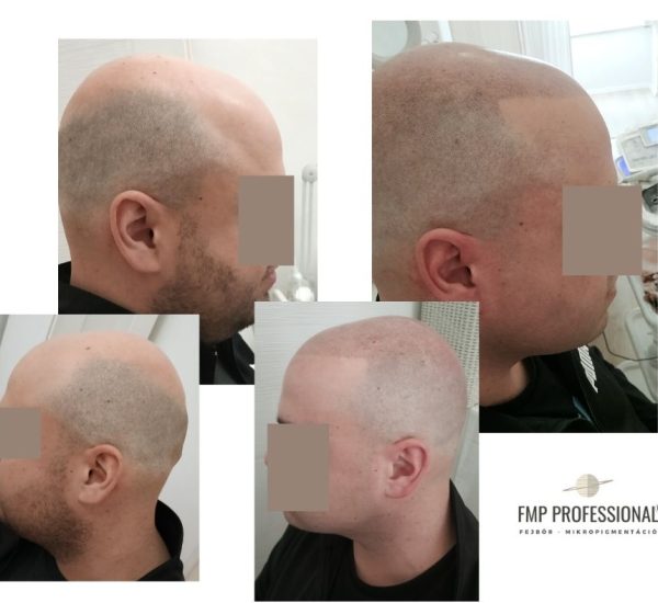 Legjobb fejbőrtetováló Budapest